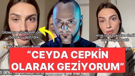 Botoks Yaptırdıktan Sonra Göz Kapağı Düştü: "Ceyda Cepkin Gibi Geziyorum"