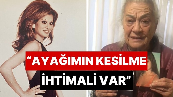 Yeşilçam’ın Bayan Bacak’ı Usta Oyuncu Serpil Örümcer’den Acil Yardım Talebi: “Ayağımın Kesilme Riski Var”