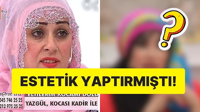 Esra Erol'da Tanıdığımız Fenomen Yazgül'ün Son Hali Şoke Etti