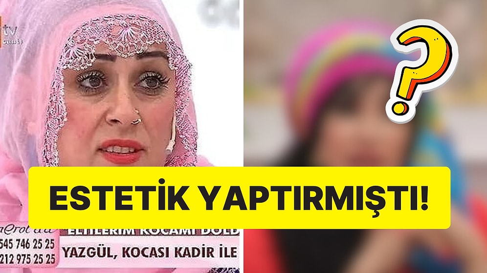 Esra Erol'da Tanıdığımız Fenomen Yazgül'ün Son Hali Şoke Etti