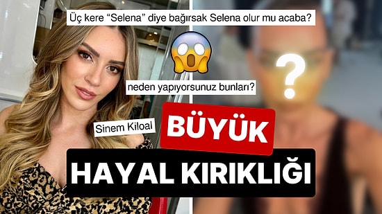 Kimse Tanıyamadı: Zayıflığıyla Dikkat Çeken Sinem Kobal'ın Yüzündeki Büyük Değişim Ağızları Açık Bıraktı!