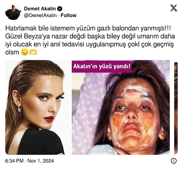 Demet Akalın 👇🏻