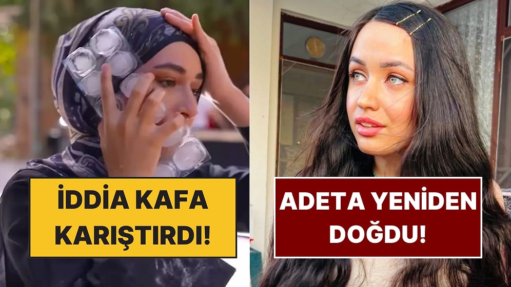 Beyza'nın Yüzüyle İlgili Ortaya Atılan İddiadan Mutlu Kaya'nın Paylaşımına TV Dünyasında Bugün Yaşananlar