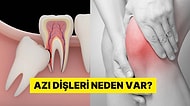 Dizler, Dişler, Omurga... İnsan Vücudundaki Tasarım Kusurları Neler?