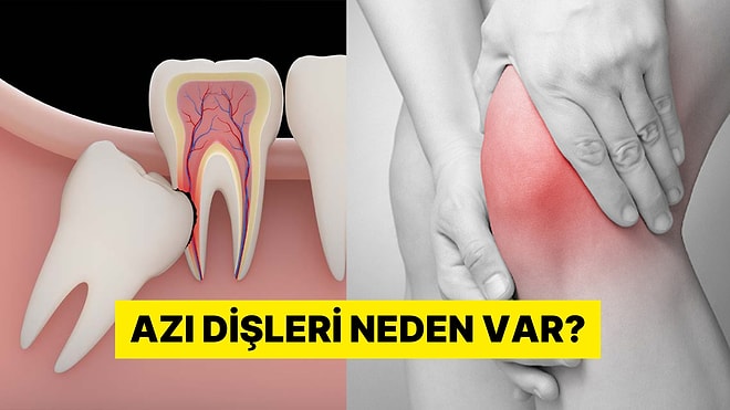 Dizler, Dişler, Omurga... İnsan Vücudundaki Tasarım Kusurları Neler?