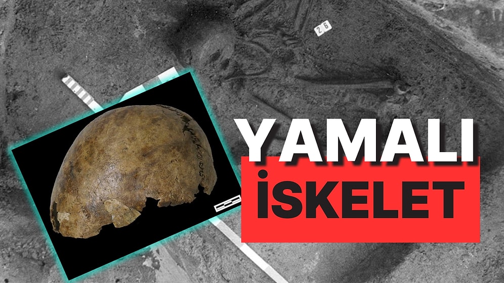 Bilim Dünyasını Şaşırtan Yamalı İskelet: Üç Bin Yıl Arayla Yaşamış Beş Kişinin Kemikleri Birleştirilmiş