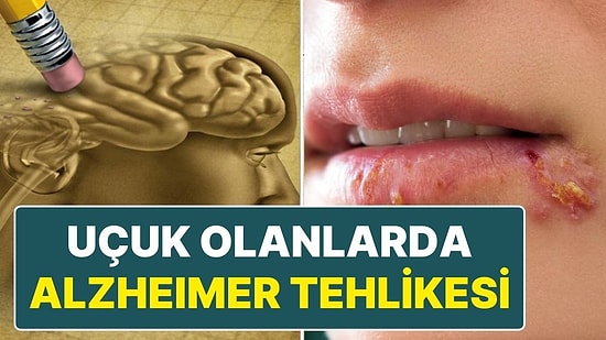 Bilim İnsanlarından Yeni Tespit: Uçuk Virüsü Alzheimer'a Neden Olabilir