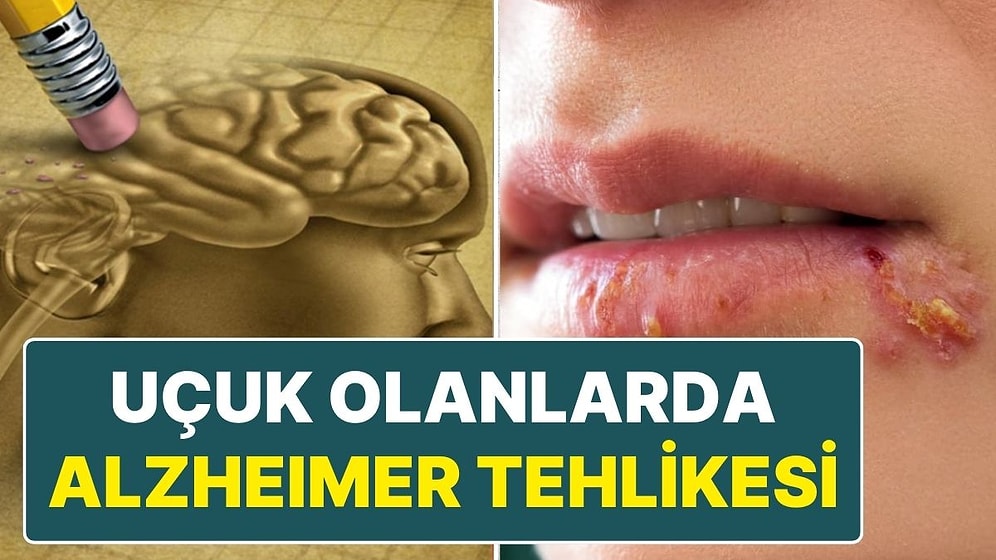 Bilim İnsanlarından Yeni Tespit: Uçuk Virüsü Alzheimer'a Neden Olabilir