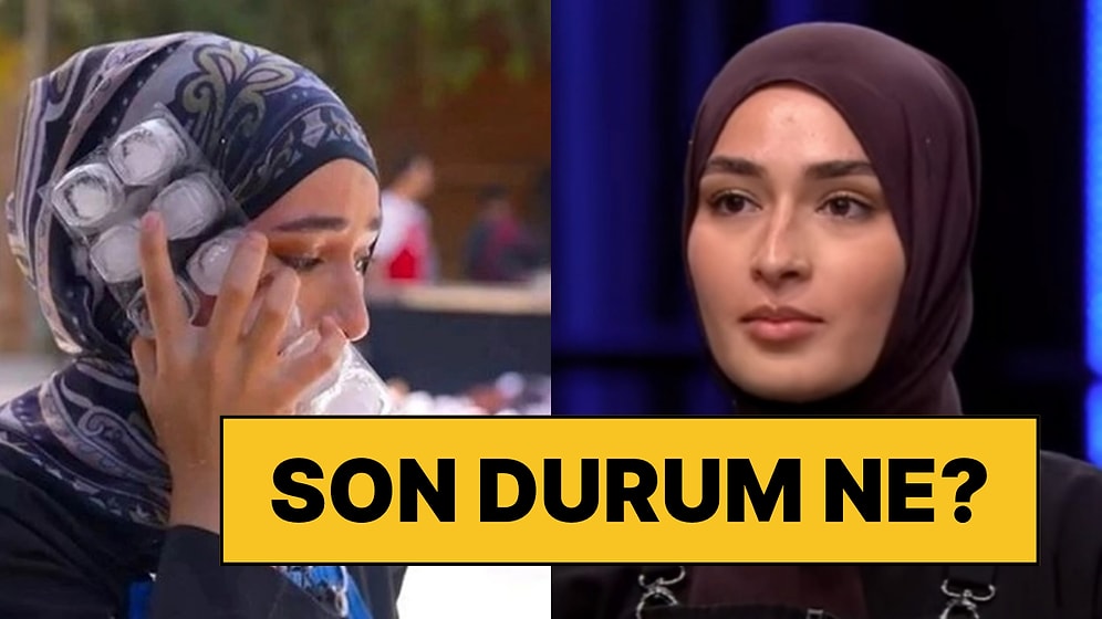 Yüzü Yanan Beyza'nın MasterChef'e Dönüp Dönmeyeceğiyle İlgili Önemli Bir İddia Ortaya Atıldı