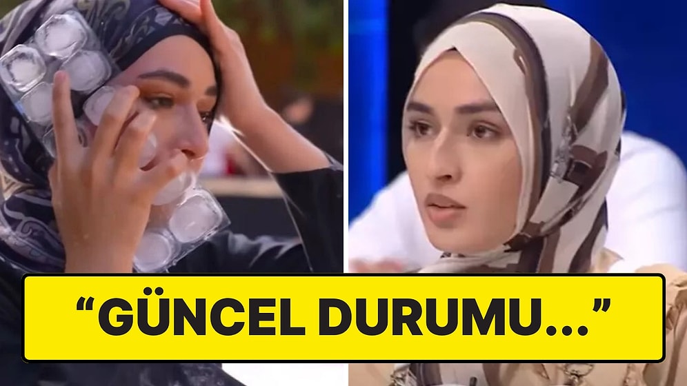 Yüzü Yanmıştı: MasterChef Beyza'nın Ablasından Yeni Açıklama!