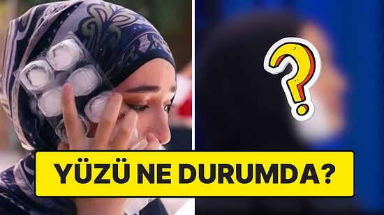 12 Gündür Hastanedeydi: Yüzü Yanan Beyza, MasterChef Stüdyosunda!