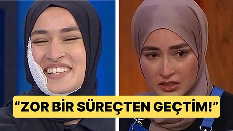 MasterChef'teki Korkunç Kazada Yüzü Feci Şekilde Yanan Beyza'dan İlk Paylaşım Geldi!