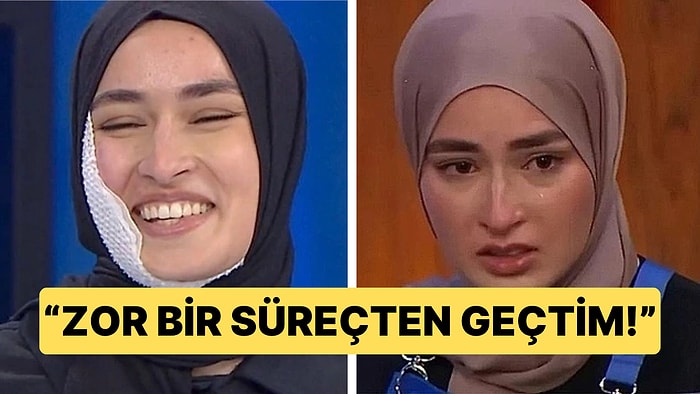 MasterChef'teki Korkunç Kazada Yüzü Feci Şekilde Yanan Beyza'dan İlk Paylaşım Geldi!