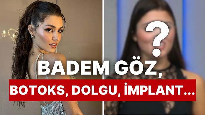 Bişektominin Kraliçesi: Tombul Yanaklarına Veda Eden Hande Erçel’in Tüm Estetiklerini İnceliyoruz!