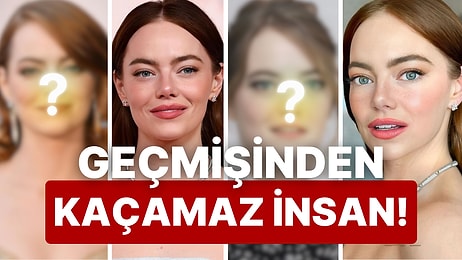 Bir Yıldız Kolay Yetişmiyor: Güzelliğiyle Büyüleyen Emma Stone'un Estetik İşlemlerini Masaya Yatırıyoruz!