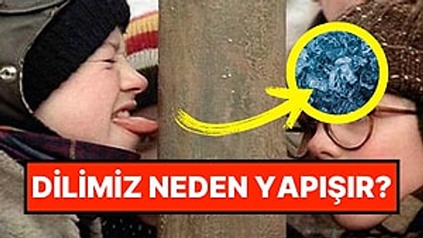 13. Hollywood Abartısı Değilmiş: Dilimiz Soğuk Metal Bir Yüzeye Değdiğinde Neden Yapışır?