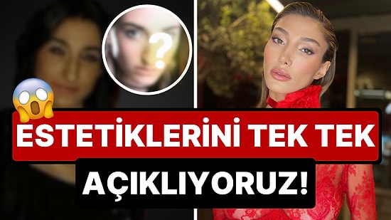 Geçmişinden Kaçamaz İnsan: 2018 Miss Turkey Güzeli Şevval Şahin'in Estetikle Bambaşka Bir Kadın Olma Serüveni!