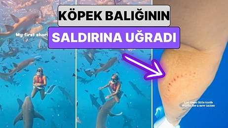 Denizin Derinliklerinde Fotoğraf Çekilmek İsteyen Bir Kadın Köpek Balığının Saldırısına Uğradı