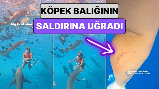 Denizin Derinliklerinde Fotoğraf Çekilmek İsteyen Bir Kadın Köpek Balığının Saldırısına Uğradı