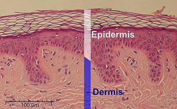 Epidermis: Bu, cildimizin üst yüzeyidir ve her 2-4 haftada bir dökülerek yenilenir. Yani, dövme burada yer alsaydı, bir süre sonra tamamen silinirdi.