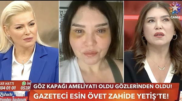 Övet yaşananların ardından neden ses çıkarmadığına dair şu ifadelerde bulundu: