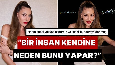 Estetik mi Zayıflık mı? ELLE Gecesine Güzelliğiyle Damga Vuran Sinem Kobal'ın Çene Dolgusu Dillere Fena Düştü!