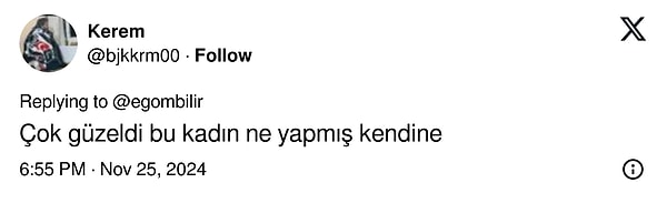 Gelin, ünlü oyuncunun yüzündeki değişime kim ne demiş birlikte bakalım!