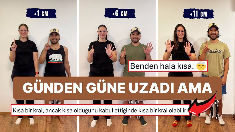 Boy Uzatma Ameliyatıyla 11 Santim Uzayan Adam Sosyal Medyanın Diline Dolaşmaktan Kurtulamadı!