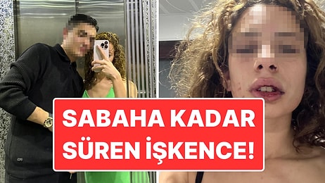 Konya’da Kadına Şiddet: 19 Yaşındaki Genç Kıza İşkence Etti, Serbest Kaldı!