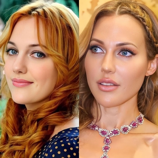 Meryem Uzerli'nin çok yuvarlak hatlara sahip bir yüzü var orijinalinde. Şu an daha da yuvarlak bir surata sahip olmasının sebebi ise kemikli görünüm yakalamak isterken artırdığı dolguların onda tam tersi şekilde sirayet etmiş olması... Elmacık dolgusu sayesinde çok daha yuvarlak ve büyük bir surat elde etmiş Uzerli.