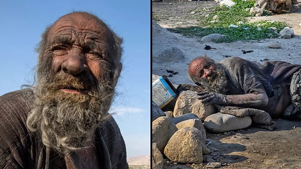 Amou Haji, hayatı boyunca su ve sabundan uzak durarak “dünyanın en kirli adamı” unvanını kazandı. Cildi, yıllarca biriken kir ve çamurla öyle kalın bir tabaka haline gelmişti ki bir yazar kendisinin "hareketsiz kaldığında bir kayaya benzediğini" söyledi.