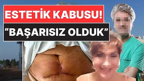 Samsun'da 62 Yaşındaki Kadının Estetik Kabusu! Doktor Hatasını Kabul Etti: "Başarısız Olduk"