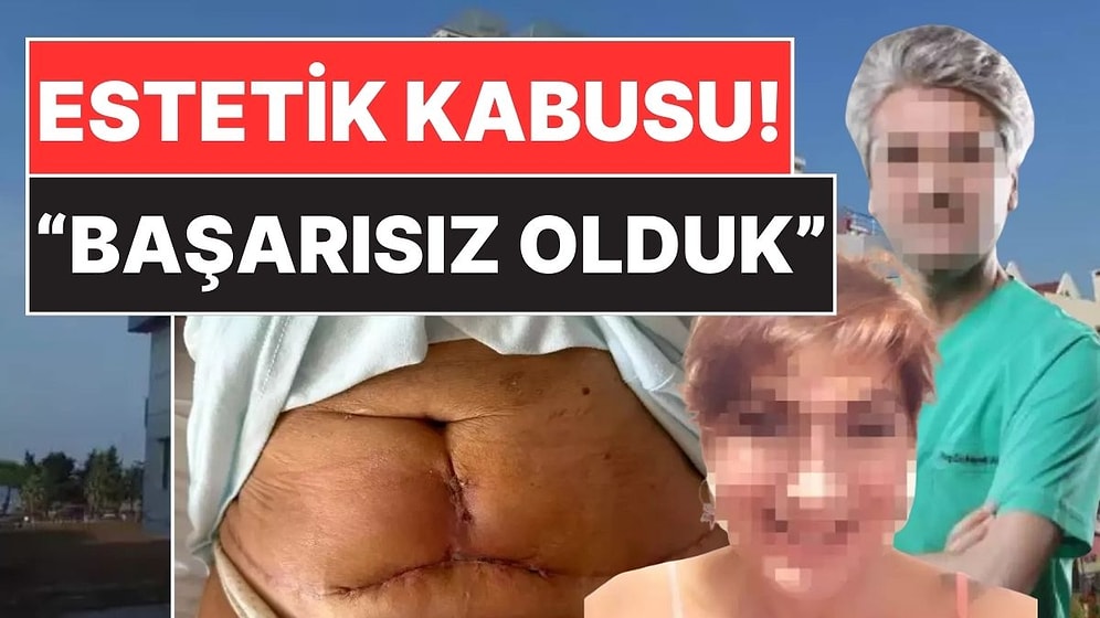 Samsun'da 62 Yaşındaki Kadının Estetik Kabusu! Doktor Hatasını Kabul Etti: "Başarısız Olduk"