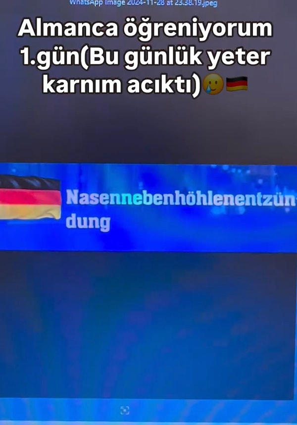 Önce sinüzit kelimesinin birkaç dildeki karşılığına baktı ve ses olarak hepsinde benzerlik söz konusuydu.