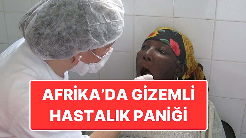 Afrika’da Gizemli Hastalık Paniği: Kısa Sürede 143 Kişi Hayatını Kaybetti