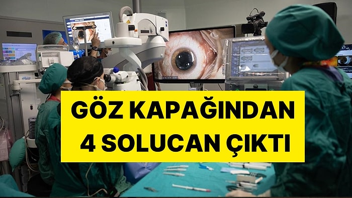 Enfeksiyon Şikayetiyle Hastaneye Gitti, Gözünden Çıkanlar Herkesi Şoke Etti: Göz Kapağından Solucan Çıktı