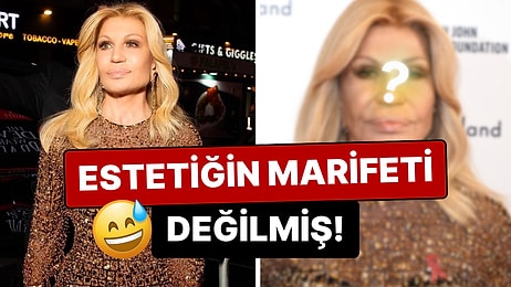 Değişimiyle Göze Çarpan Donatella Versace'nin Evrimi Estetik Operasyonların Değil Fotoşopun Marifetiymiş!