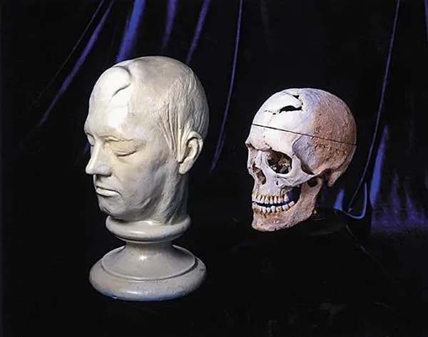 Phineas Gage’in vakası, nörobilim alanında bir dönüm noktası oldu. Dr. John Martyn Harlow’un raporları sayesinde, beyin travmaları ile kişilik değişimleri arasındaki bağlantı ilk kez bilimsel olarak ortaya kondu.