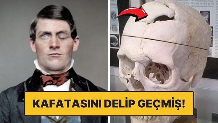 Beyni Delip Geçen Demir Çubukla Hayatta Kalan Adam: Phineas Gage’in Akıl Almaz Hikayesi!