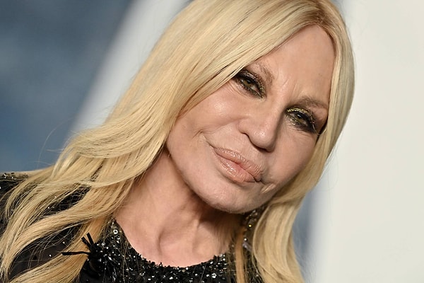 Versace's cosmetic surgeries have also been a hot topic in the entertainment world.