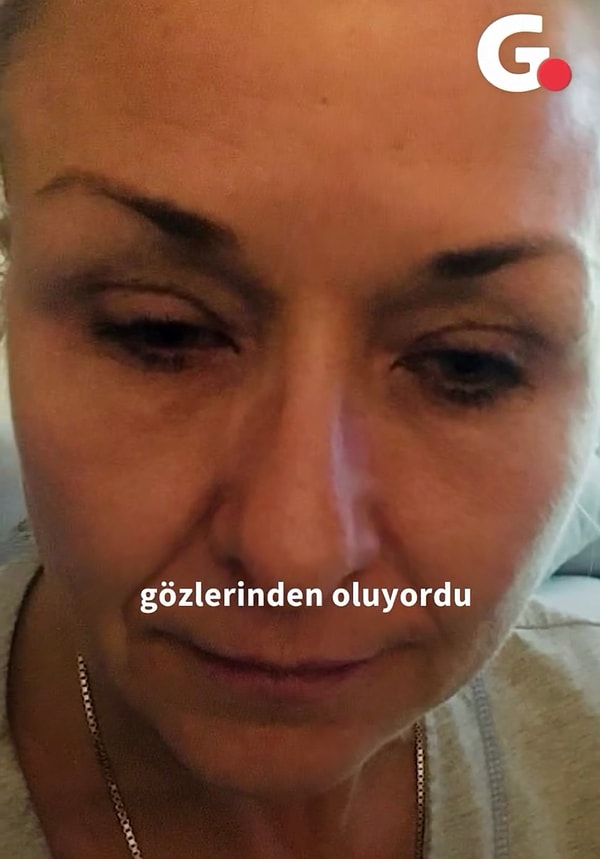 Theresa adlı kadın, maskarasını hiç temizlemeden her gün üstüne yenisini sürdü ve 25 yıl boyunca bu durumu tekrarladı.