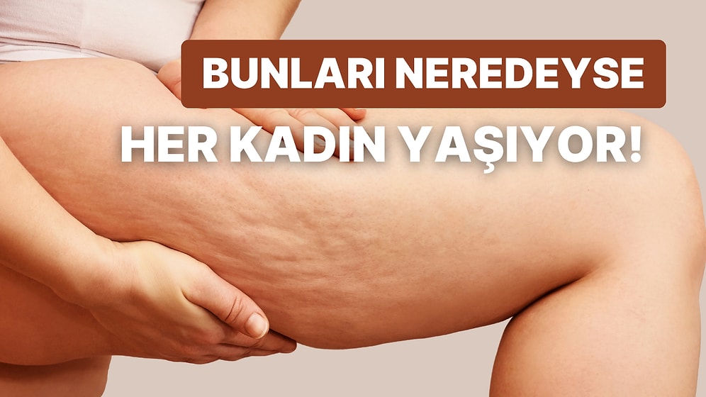 Bunlar Kusur Değil, İnsanlık Göstergesi! Her Kadında Olması Muhtemel 12 Şey