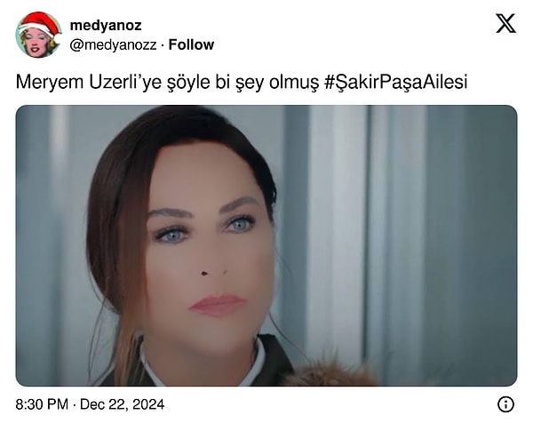 Kullanıcılar shopun abartıldığını düşünerek ''Meryem Uzerli'ye şöyle bir şey olmuş'' gibi esprili yorumlar yaparken, bazıları ise güzel oyuncunun yüzüne bir şey yaptırdığını söyleyerek estetik iddialarını gündeme taşıdı.