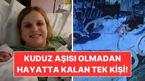 Kuduz Aşısı Olmadan Hayatta Kalan Jeanna Giese'nin Tıp Dünyasını Şaşırtan Hikayesi