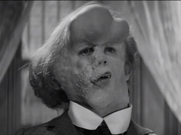 Ayrıca Joseph'in hayatını konu alan 1980 yapımı "The Elephant Man" adlı bir filmi de var. Yönetmenliğini David Lynch'in üstlendiği film, IMDb'de 8.2 puana sahip.