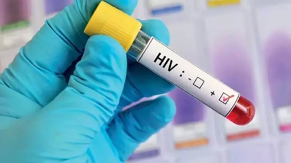 HIV+, HIV taşıyıcısı olduğun anlamına gelir, ancak bu AIDS olduğun anlamına gelmez.