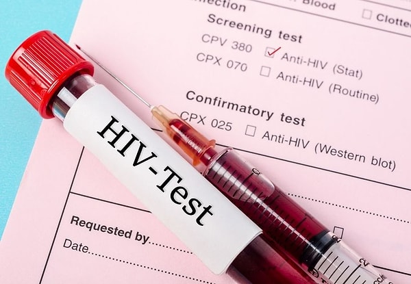HIV sadece test yolu ile öğrenilir, o yüzden erken teşhis için düzenli test yaptırmak önemlidir.