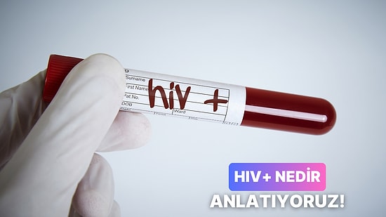 Sandığın Kadar Korkunç Bir Şey Olmadığını Söyleyelim! HIV+ Nedir?