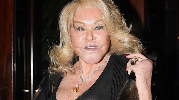 Yüzüne yaptırdığı estetik işlemler sonrası Cat Woman (Kedi Kadın) olarak anılmaya başlayan Jocelyn Wildenstein, 84 yaşında hayatını kaybetti.