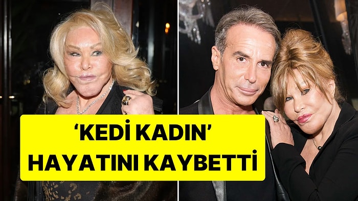 "Hiç Estetik Olmadım" Diyen Kedi Kadın Lakaplı Jocelyn Wildenstein Hayatını Kaybetti: İşte İlginç Hikayesi